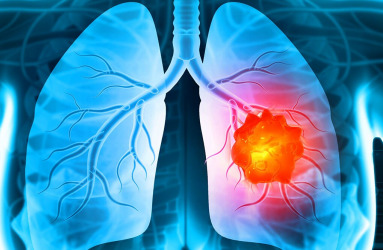 lung